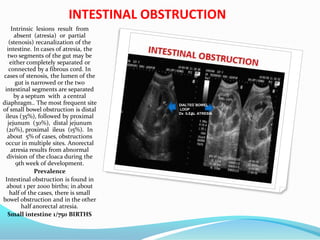 INTESTINAL OBSTRUCTION
Intrinsic lesions result from
absent (atresia) or partial
(stenosis) recanalization of the
intestine. In cases of atresia, the
two segments of the gut may be
either completely separated or
connected by a fibrous cord. In
cases of stenosis, the lumen of the
gut is narrowed or the two
intestinal segments are separated
by a septum with a central
diaphragm.. The most frequent site
of small bowel obstruction is distal
ileus (35%), followed by proximal
jejunum (30%), distal jejunum
(20%), proximal ileus (15%). In
about 5% of cases, obstructions
occur in multiple sites. Anorectal
atresia results from abnormal
division of the cloaca during the
9th week of development.
Prevalence
Intestinal obstruction is found in
about 1 per 2000 births; in about
half of the cases, there is small
bowel obstruction and in the other
half anorectal atresia.
Small intestine 1/750 BIRTHS
DIALTED BOWEL
LOOP
Dx ILEAL ATRESIA
 