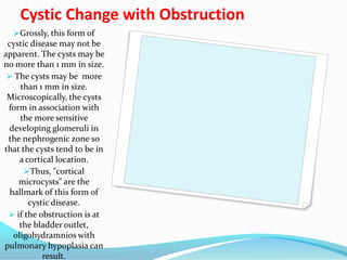 Cystic Change with Obstruction
Grossly, this form of
cystic disease may not be
apparent. The cysts may be
no more than 1 mm in size.
 The cysts may be more
than 1 mm in size.
Microscopically, the cysts
form in association with
the more sensitive
developing glomeruli in
the nephrogenic zone so
that the cysts tend to be in
a cortical location.
Thus, "cortical
microcysts" are the
hallmark of this form of
cystic disease.
 if the obstruction is at
the bladder outlet,
oligohydramnios with
pulmonary hypoplasia can
result.
 