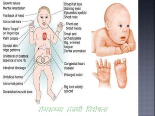 Graphical Abstract Birth Defect Birth defects | PPTX