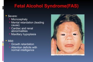 Birth Defects (EMBRYOLOGY - MBBS) by Dr. Sitwat.ppt