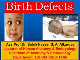Birth Defects
Ass.Prof.Dr. Saleh Nasser S. A. Alkardae
Lecturer of Human Anatomy & Embryology
Chairman of Anatomy & Embryology
Department, TUFOM_GUSTFOM
 