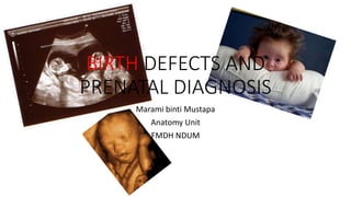 BIRTH DEFECTS AND 
PRENATAL DIAGNOSIS 
Marami binti Mustapa 
Anatomy Unit 
FMDH NDUM 
 