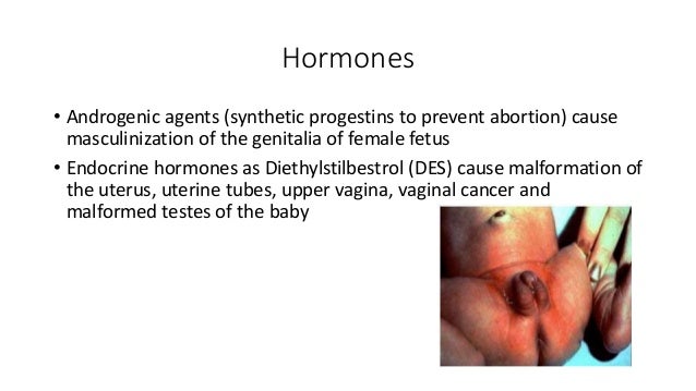 What are some abnormalities of the uterus?