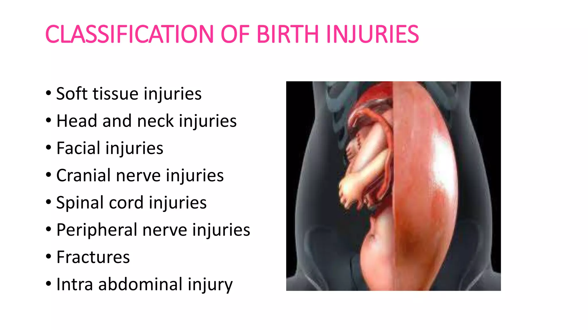 Birth injuries | PPTX