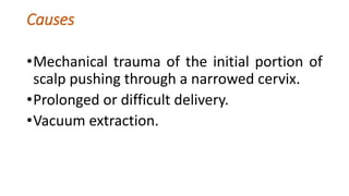 Causes
•Mechanical trauma of the initial portion of
scalp pushing through a narrowed cervix.
•Prolonged or difficult delivery.
•Vacuum extraction.
 