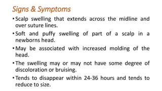 Signs & Symptoms
• Scalp swelling that extends across the midline and
over suture lines.
• Soft and puffy swelling of part of a scalp in a
newborns head.
• May be associated with increased molding of the
head.
• The swelling may or may not have some degree of
discoloration or bruising.
• Tends to disappear within 24-36 hours and tends to
reduce to size.
 