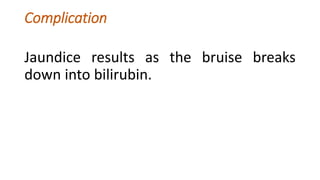 Complication
Jaundice results as the bruise breaks
down into bilirubin.
 