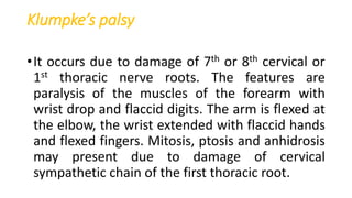 Klumpke’s palsy
•It occurs due to damage of 7th or 8th cervical or
1st thoracic nerve roots. The features are
paralysis of the muscles of the forearm with
wrist drop and flaccid digits. The arm is flexed at
the elbow, the wrist extended with flaccid hands
and flexed fingers. Mitosis, ptosis and anhidrosis
may present due to damage of cervical
sympathetic chain of the first thoracic root.
 