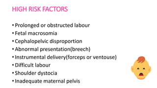 HIGH RISK FACTORS
• Prolonged or obstructed labour
• Fetal macrosomia
• Cephalopelvic disproportion
• Abnormal presentation(breech)
• Instrumental delivery(forceps or ventouse)
• Difficult labour
• Shoulder dystocia
• Inadequate maternal pelvis
 