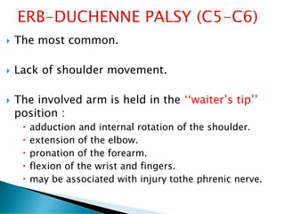  The most common.
 Lack of shoulder movement.
 The involved arm is held in the ‘‘waiter’s tip’’
position :
 adduction and internal rotation of the shoulder.
 extension of the elbow.
 pronation of the forearm.
 flexion of the wrist and fingers.
 may be associated with injury tothe phrenic nerve.
 