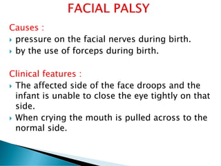 Causes :
 pressure on the facial nerves during birth.
 by the use of forceps during birth.
Clinical features :
 The affected side of the face droops and the
infant is unable to close the eye tightly on that
side.
 When crying the mouth is pulled across to the
normal side.
 
