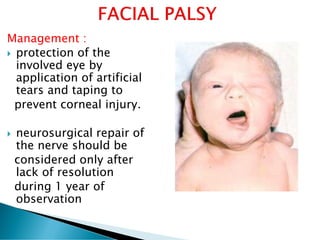 Management :
 protection of the
involved eye by
application of artificial
tears and taping to
prevent corneal injury.
 neurosurgical repair of
the nerve should be
considered only after
lack of resolution
during 1 year of
observation
 