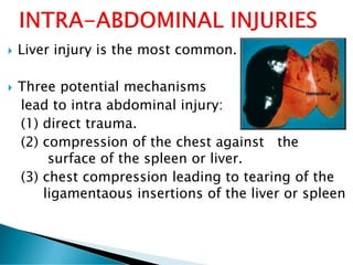  Liver injury is the most common.
 Three potential mechanisms
lead to intra abdominal injury:
(1) direct trauma.
(2) compression of the chest against the
surface of the spleen or liver.
(3) chest compression leading to tearing of the
ligamentaous insertions of the liver or spleen
 