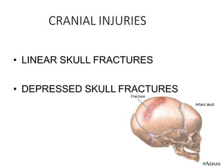 CRANIAL INJURIES
• LINEAR SKULL FRACTURES
• DEPRESSED SKULL FRACTURES
 