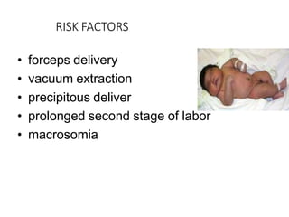 RISK FACTORS
• forceps delivery
• vacuum extraction
• precipitous deliver
• prolonged second stage of labor
• macrosomia
 