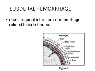 SUBDURAL HEMORRHAGE
• most frequent intracranial hemorrhage
related to birth trauma
 