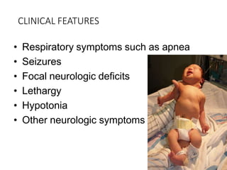 CLINICAL FEATURES
• Respiratory symptoms such as apnea
• Seizures
• Focal neurologic deficits
• Lethargy
• Hypotonia
• Other neurologic symptoms
 