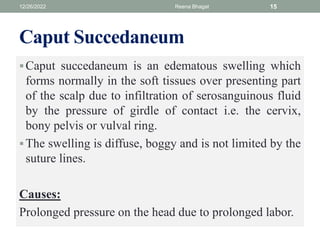 Caput Succedaneum
Caput succedaneum is an edematous swelling which
forms normally in the soft tissues over presenting part
of the scalp due to infiltration of serosanguinous fluid
by the pressure of girdle of contact i.e. the cervix,
bony pelvis or vulval ring.
The swelling is diffuse, boggy and is not limited by the
suture lines.
Causes:
Prolonged pressure on the head due to prolonged labor.
12/26/2022 Reena Bhagat 15
 