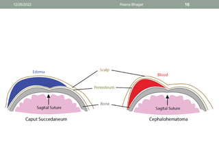 12/26/2022 Reena Bhagat 16
 