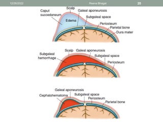 12/26/2022 Reena Bhagat 20
 