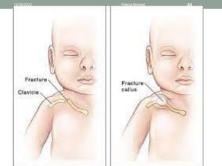 12/26/2022 Reena Bhagat 44
 