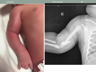 12/26/2022 Reena Bhagat 47
 