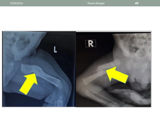 12/26/2022 Reena Bhagat 49
 