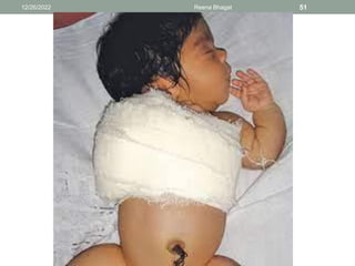 12/26/2022 Reena Bhagat 51
 