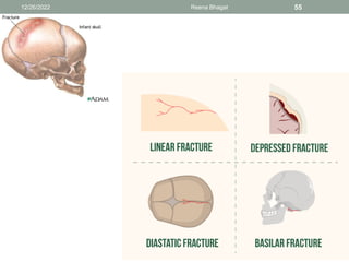 12/26/2022 Reena Bhagat 55
 