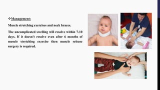 Management:
Muscle stretching exercises and neck braces.
The uncomplicated swelling will resolve within 7-10
days. If it doesn't resolve even after 6 months of
muscle stretching exercise then muscle release
surgery is required.
 