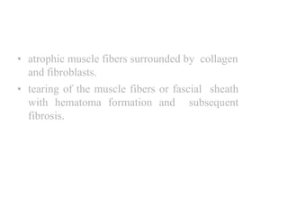 CONGENITAL MUSCULAR
TORTICOLLIS
• atrophic muscle fibers surrounded by collagen
and fibroblasts.
• tearing of the muscle fibers or fascial sheath
with hematoma formation and subsequent
fibrosis.
 