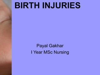BIRTH INJURIES
Payal Gakhar
I Year MSc Nursing
 