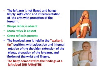 Birth Injuries OF THE BRACHIAL PLEXUS Dr. Ayman Awlia.pptx