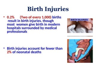 common Birth Injuries ppt in neonates .pptx
