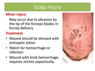 Scalp injury
Miner injury
May occur due to abrasion by
the tip of the forceps blades in
forcep delivery
Treatment
• Wound should be dressed with
antiseptic lotion
• Watch for hemorrhage or
infection
• Wound with brisk hemorrhage
requires stiches aspectically.
 