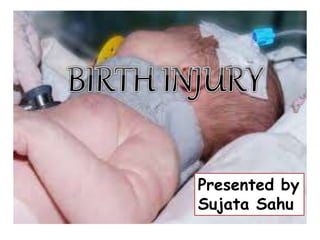 Presented by
Sujata Sahu
 