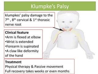 Klumpke’s Palsy
klumpkes’ palsy damage to the
7th , 8th cervical & 1st thorasic
nerve root
Clinical feature
•Arm is flexed at elbow
•Wrist is extended
•Forearm is supinated
•A claw like deformity
of the hand
Treatment
Physical therapy & Passive movement
Full recovery takes weeks or even months
 