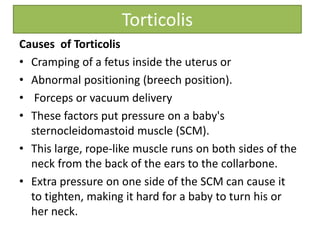 Torticolis
Causes of Torticolis
• Cramping of a fetus inside the uterus or
• Abnormal positioning (breech position).
• Forceps or vacuum delivery
• These factors put pressure on a baby's
sternocleidomastoid muscle (SCM).
• This large, rope-like muscle runs on both sides of the
neck from the back of the ears to the collarbone.
• Extra pressure on one side of the SCM can cause it
to tighten, making it hard for a baby to turn his or
her neck.
 