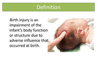 Definition
Birth injury is an
impairment of the
infant’s body function
or structure due to
adverse influence that
occurred at birth.
 