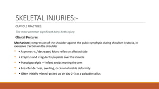 SKELETAL INJURIES:-
CLAVICLE FRACTURE:
The most common significant bony birth injury
Clinical Features:
Mechanism: compression of the shoulder against the pubic symphysis during shoulder dystocia, or
excessive traction on the shoulder
 • Asymmetric / decreased Moro reflex on affected side
• • Crepitus and irregularity palpable over the clavicle
• • Pseudoparalysis — infant avoids moving the arm
• • Local tenderness, swelling, occasional visible deformity
• • Often initially missed; picked up on day 2–3 as a palpable callus
 