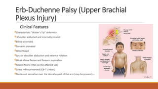 Clinical Features
Characteristic "Waiter's Tip" deformity
:Shoulder adducted and internally rotated
Elbow extended
Forearm pronated
Wrist flexed
Loss of shoulder abduction and external rotation
Weak elbow flexion and forearm supination
Absent Moro reflex on the affected side
Grasp reflex preserved (C8–T1 intact)
Decreased sensation over the lateral aspect of the arm (may be present)---
Erb-Duchenne Palsy (Upper Brachial
Plexus Injury)
 