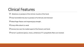 Clinical Features
 . Weakness or paralysis of the intrinsic muscles of the hand.
 Claw hand deformity due to paralysis of lumbricals and interossei
 Weak finger flexion and impaired grip strength.
 Grasp reflex absent or weak
 Sensory loss over the medial aspect of the forearm and hand.
 Horner's syndrome (ptosis, miosis, anhidrosis) if T1 sympathetic fibers are involved.
 