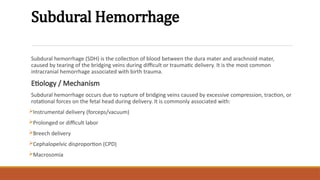 Subdural Hemorrhage
Subdural hemorrhage (SDH) is the collection of blood between the dura mater and arachnoid mater,
caused by tearing of the bridging veins during difficult or traumatic delivery. It is the most common
intracranial hemorrhage associated with birth trauma.
Etiology / Mechanism
Subdural hemorrhage occurs due to rupture of bridging veins caused by excessive compression, traction, or
rotational forces on the fetal head during delivery. It is commonly associated with:
Instrumental delivery (forceps/vacuum)
Prolonged or difficult labor
Breech delivery
Cephalopelvic disproportion (CPD)
Macrosomia
 