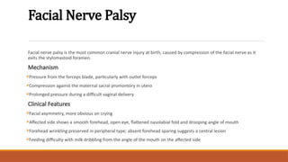 Facial Nerve Palsy
Facial nerve palsy is the most common cranial nerve injury at birth, caused by compression of the facial nerve as it
exits the stylomastoid foramen.
Mechanism
Pressure from the forceps blade, particularly with outlet forceps
Compression against the maternal sacral promontory in utero
Prolonged pressure during a difficult vaginal delivery
Clinical Features
Facial asymmetry, more obvious on crying
Affected side shows a smooth forehead, open eye, flattened nasolabial fold and drooping angle of mouth
Forehead wrinkling preserved in peripheral type; absent forehead sparing suggests a central lesion
Feeding difficulty with milk dribbling from the angle of the mouth on the affected side
 