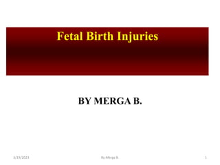 Fetal Birth Injuries
BY MERGA B.
3/19/2023 By Merga B. 1
 