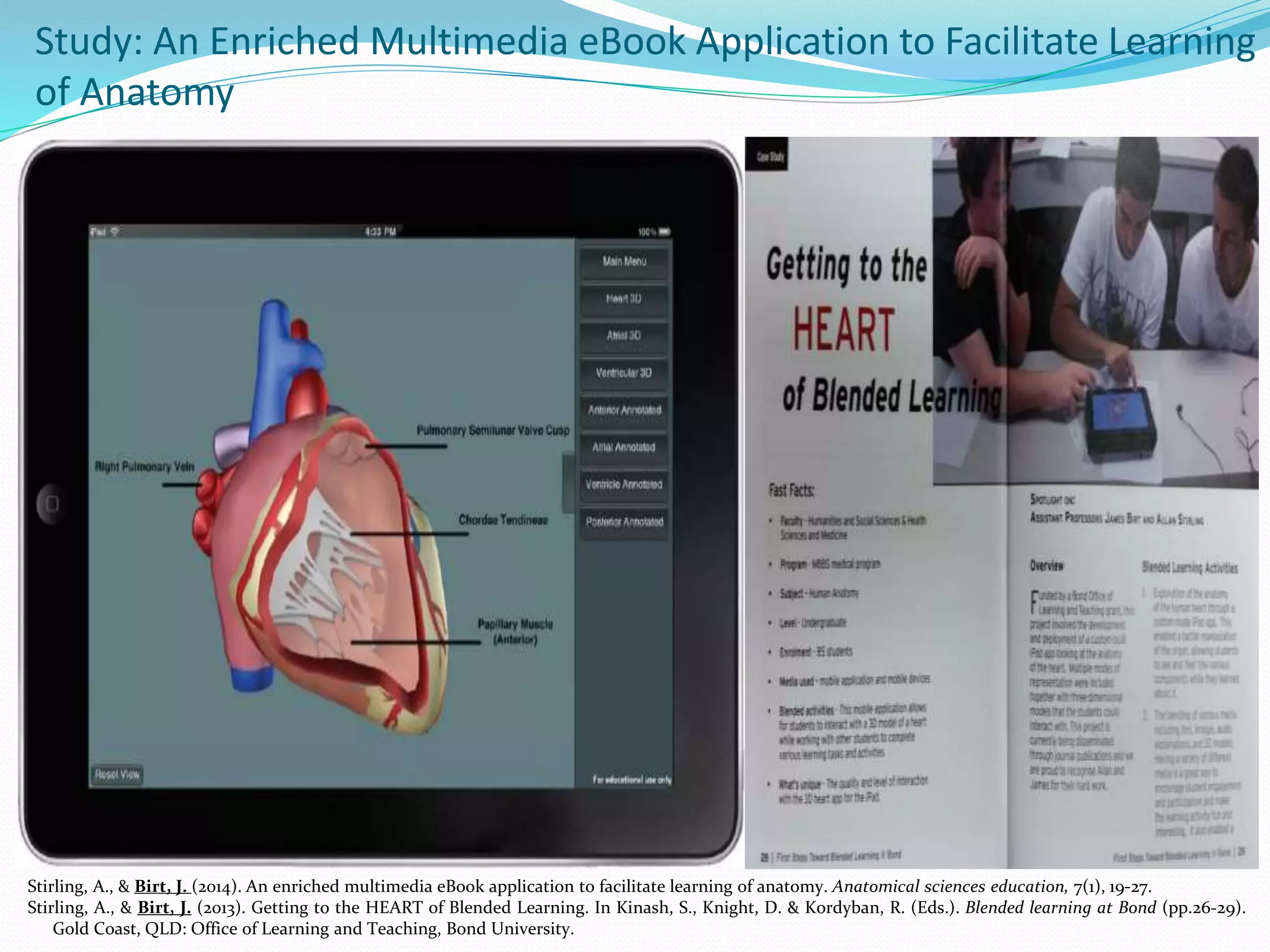 Stirling, A., & Birt, J. (2014). An enriched multimedia eBook application to facilitate learning of anatomy. Anatomical sciences education, 7(1), 19-27.
Stirling, A., & Birt, J. (2013). Getting to the HEART of Blended Learning. In Kinash, S., Knight, D. & Kordyban, R. (Eds.). Blended learning at Bond (pp.26-29).
Gold Coast, QLD: Office of Learning and Teaching, Bond University.
Study: An Enriched Multimedia eBook Application to Facilitate Learning
of Anatomy
 