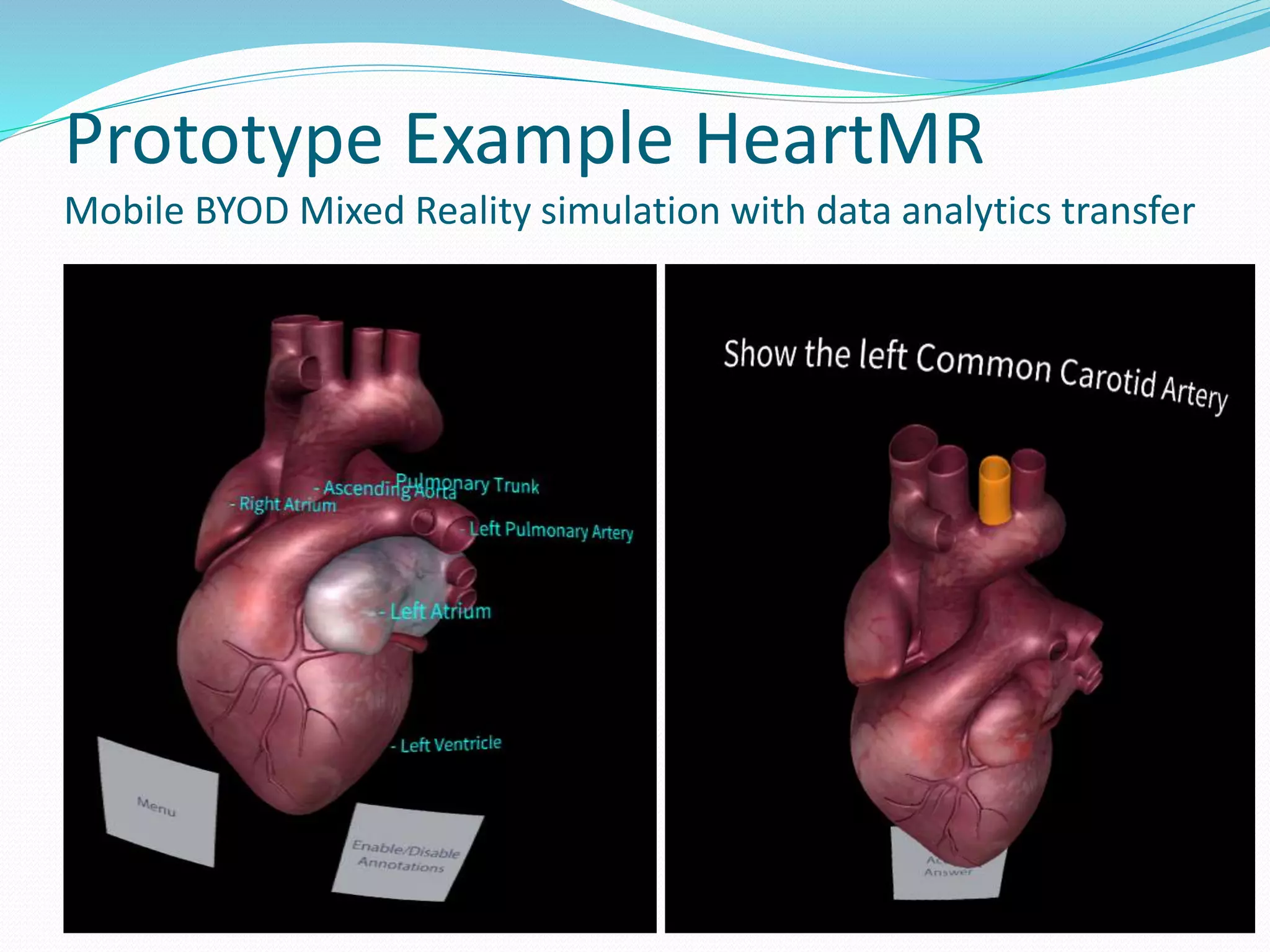 Prototype Example HeartMR
Mobile BYOD Mixed Reality simulation with data analytics transfer
26
 