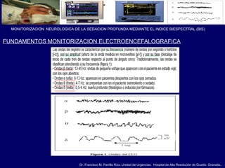 Dr. Francisco M. Parrilla Ruiz. Unidad de Urgencias. Hospital de Alta Resolución de Guadix. Granada.
MONITORIZACION NEUROLOGICA DE LA SEDACION PROFUNDA MEDIANTE EL INDICE BIESPECTRAL (BIS)
FUNDAMENTOS MONITORIZACION ELECTROENCEFALOGRAFICA
 