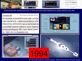 Dr. Francisco M. Parrilla Ruiz. Unidad de Urgencias. Hospital de Alta Resolución de Guadix. Granada.
MONITORIZACION NEUROLOGICA DE LA SEDACION PROFUNDA MEDIANTE EL INDICE BIESPECTRAL (BIS)
DSC
1994
 
