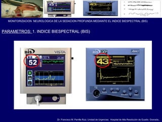 Dr. Francisco M. Parrilla Ruiz. Unidad de Urgencias. Hospital de Alta Resolución de Guadix. Granada.
MONITORIZACION NEUROLOGICA DE LA SEDACION PROFUNDA MEDIANTE EL INDICE BIESPECTRAL (BIS)
PARAMETROS: 1. INDICE BIESPECTRAL (BIS)
 